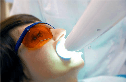 Understanding the Causes of Teeth Sensitivity Rugby