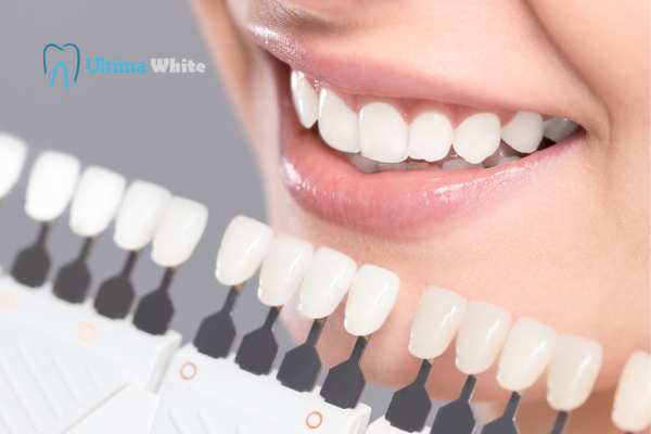 How to Maximise the Results of Your Laser Teeth Whitening Treatment Rugby