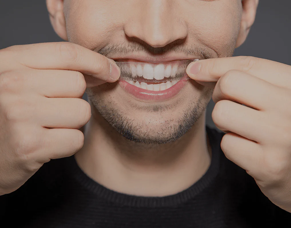 How Are Invisible Aligners Changing Orthodontic Treatments Rugby?