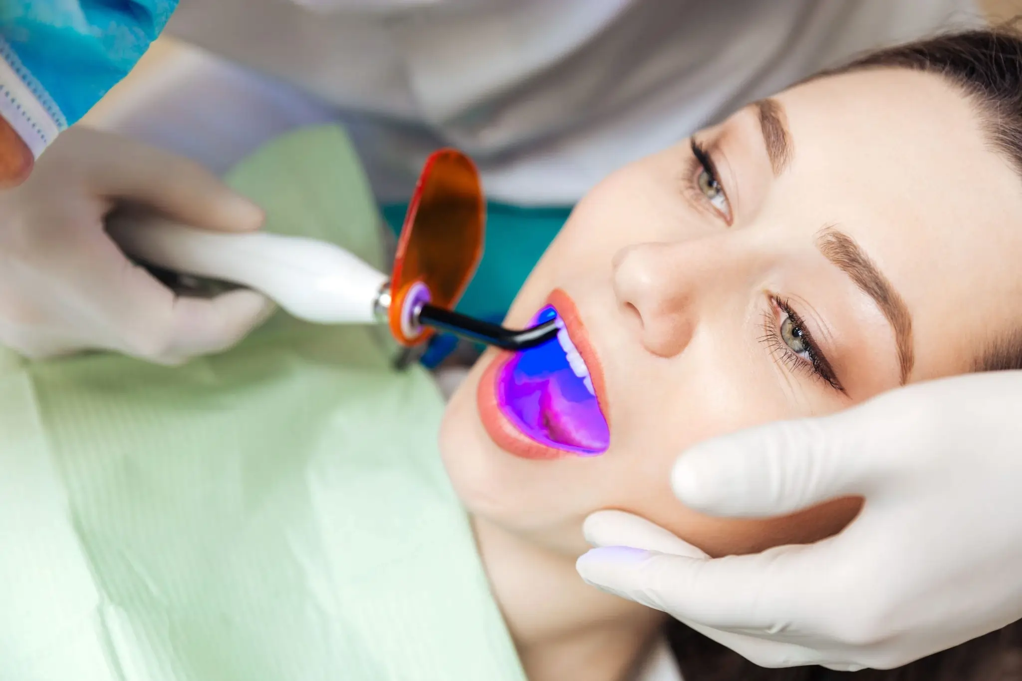 What You Need to Know Before Brightening Your Smile Rugby