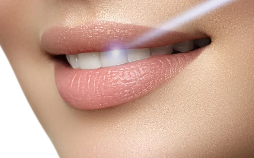 Understanding Teeth Whitening Risks and Results Rugby