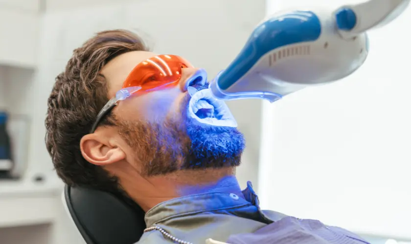 Is Laser Teeth Whitening Worth It? Pros, Cons, and Alternatives Explained Rugby