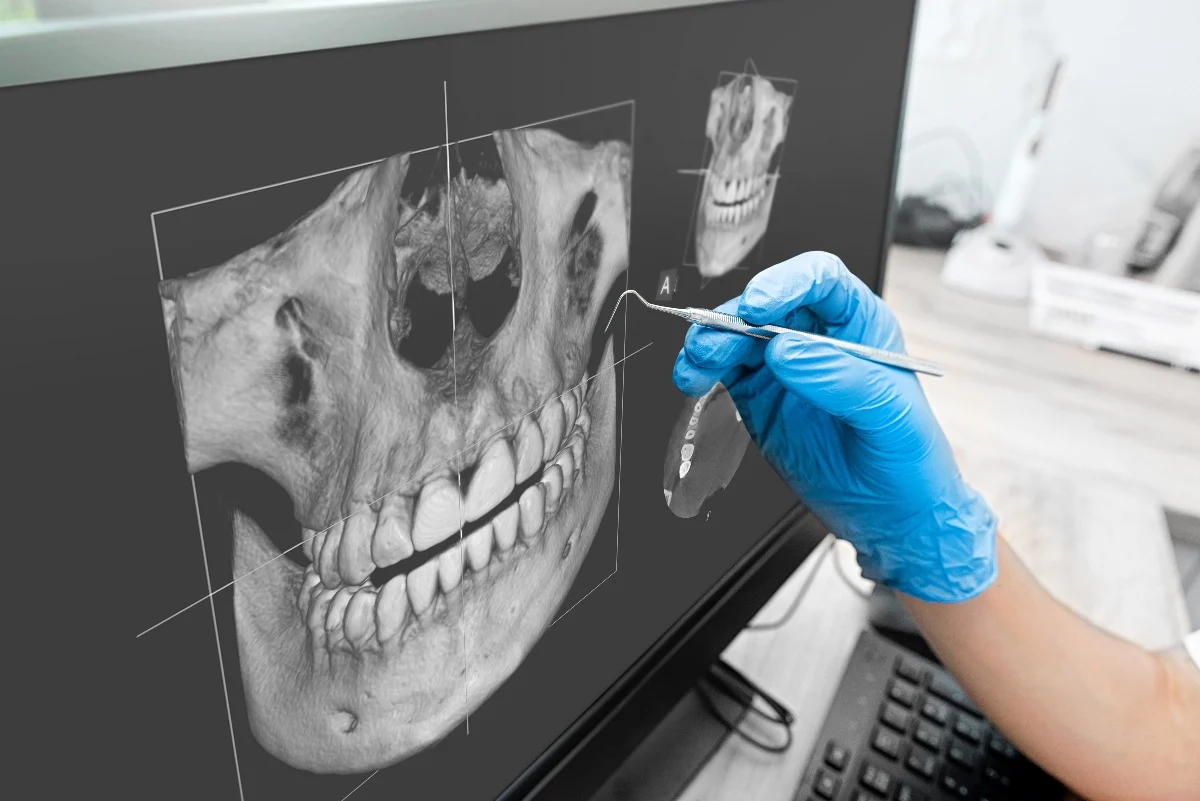 How Is AI Transforming Dental Treatment Planning Rugby?