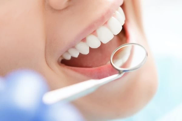 How to Maintain Your Whiter Smile After Treatment Rugby