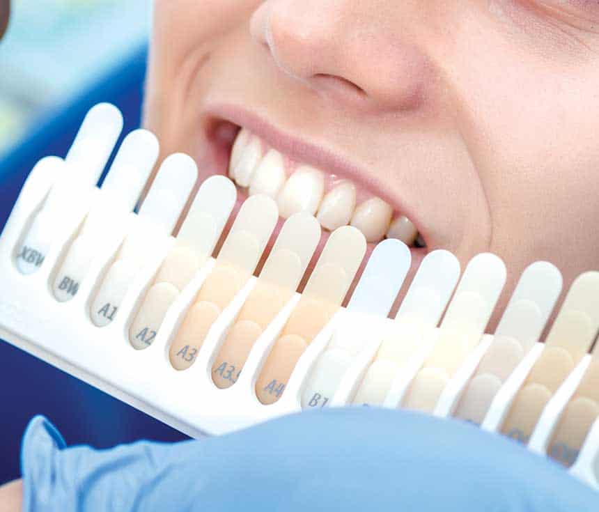 Is Laser Teeth Whitening Worth It for a Brighter, Confident Smile Rugby?