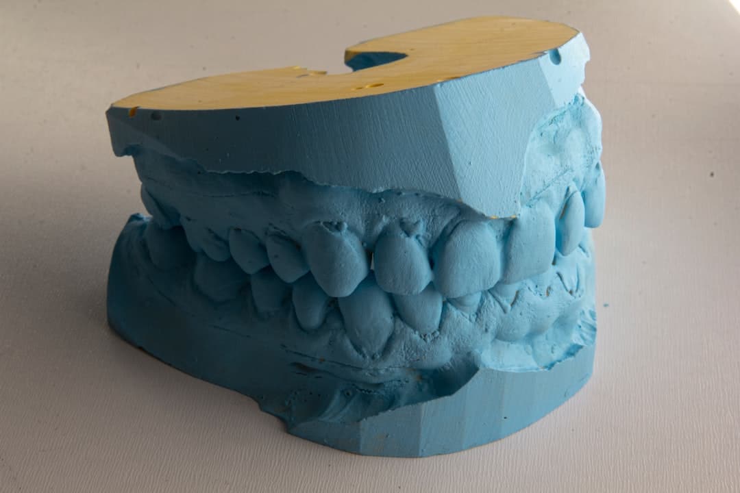 How Do Dental Implants Improve Jawbone Health and Oral Function Rugby?