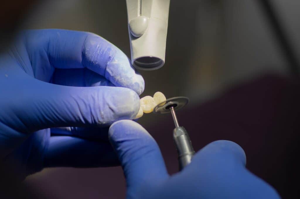 Customised Dental Solutions: Crowns, Aligners, and Implants Rugby