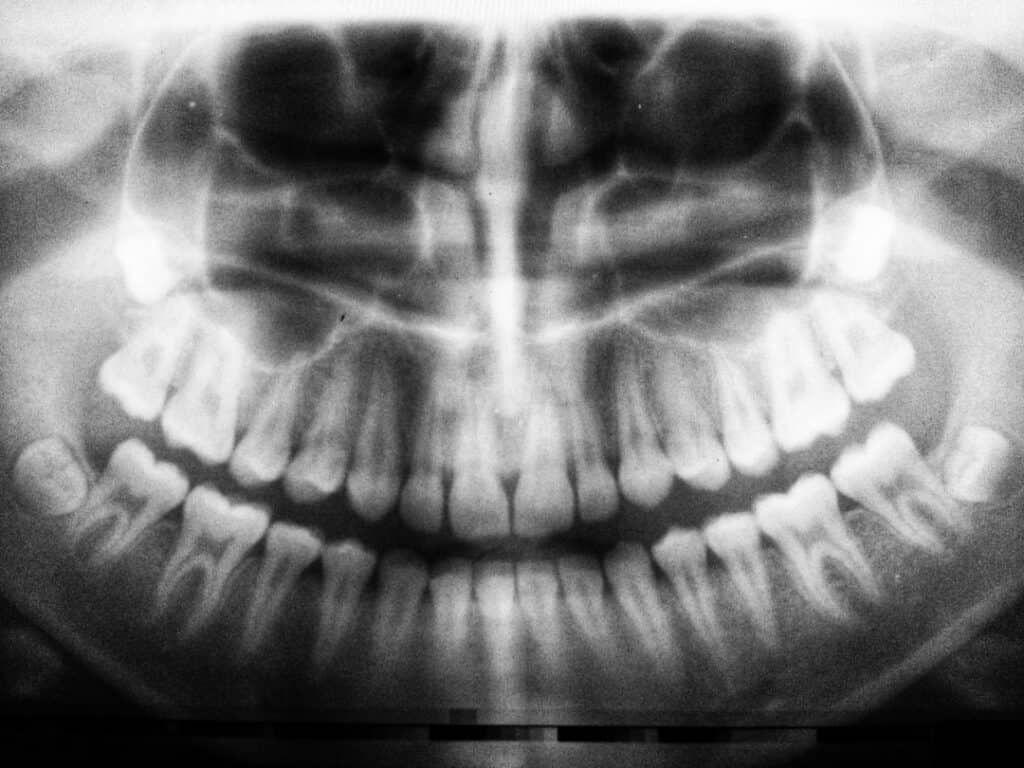 The Future of 3D Printing in Oral Healthcare Rugby